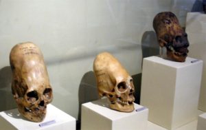Paracas Skulls (Photo source: Wikimedia Commons)